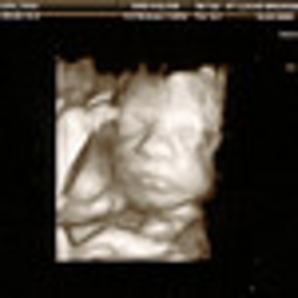 Beetje veel water hier