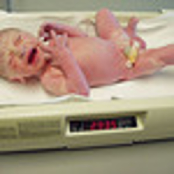 Twee beentjes en voetjes kortom alles erop en eraan