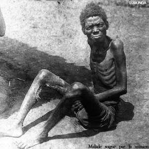 LUBUNDA habitant malade.