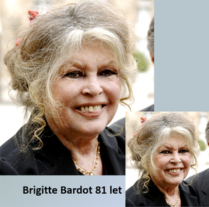 Brigitte Bardot-rimpels reduceren