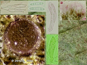 Pyrenopeziza-plantaginis-Weegbreeuitbreekkommetje_20140820MH