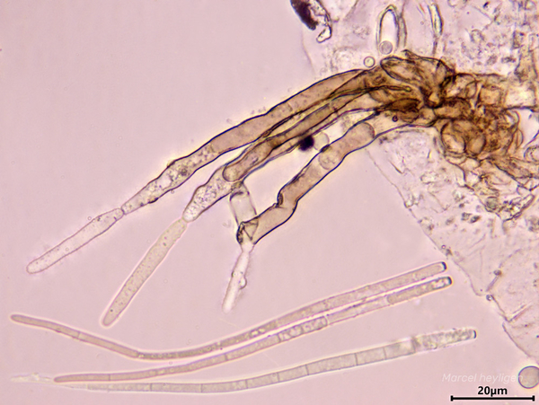 Cercospora beticola