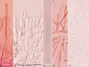 Lachnum-reynoutriae-microscopie-20250529-8
