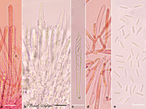 Lachnum-reynoutriae-microscopie-20250529-8