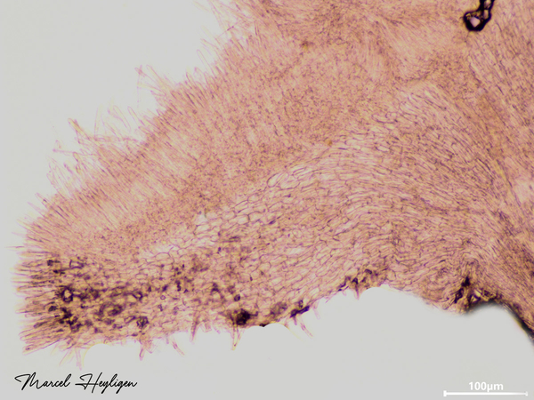 Lachnum-reynoutriae_20250529MH0036-8