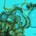 Chaetomium-globosum─Kromharig-kwastkopje_-20251016MH1006-8