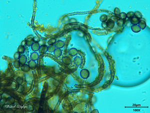 Chaetomium-globosum─Kromharig-kwastkopje_-20251016MH1006-8