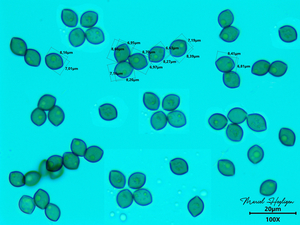 Chaetomium-globosum─Kromharig-kwastkopje_-20251016MH4002-8